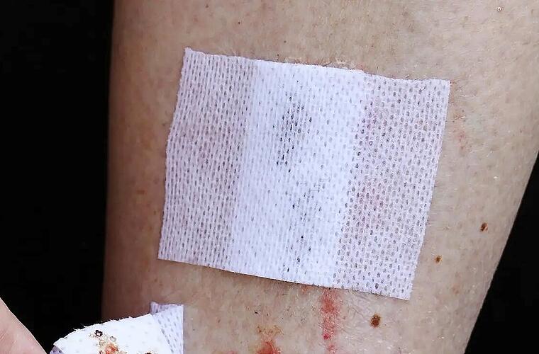 Ich habe eine kleine Wunde am Bein, ohne erkennbare Ursache Warum verheilt sie nicht?